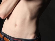 Radiografía de abdomen: qué necesitas saber