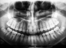 odontologia moraleja